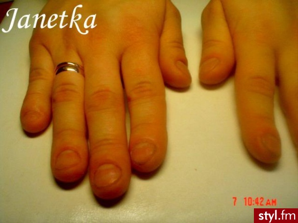 Autor: jarek Prace Janetki. Autor: <b>jarek</b><br /> - Paznokcie